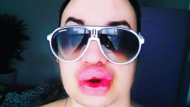Cyril roux filler bibir demi mirip Marilyn Monroe  (Foto: Dok. medium drum)
