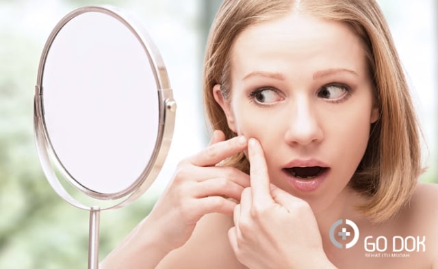 6 Cara Cantik Usir Jerawat Batu yang Mengusik