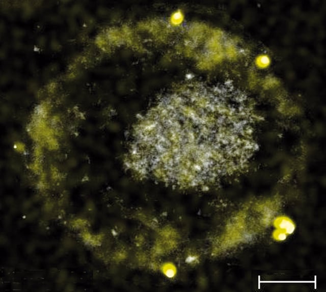 C. metallidurans, bakteri pembuat emas (Foto: American Society for Microbiology)