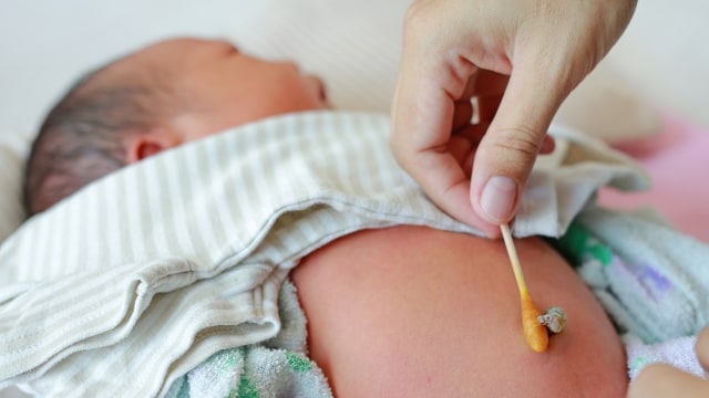 Perawatan tali pusar bayi baru lahir. (Foto: Shutterstock)
