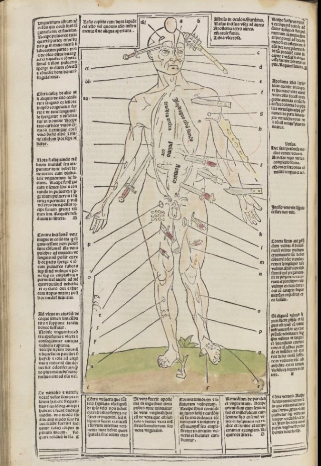 Bagian dari Buku Fasciculus Medicinae  (Foto: New York Academy of Medicine)