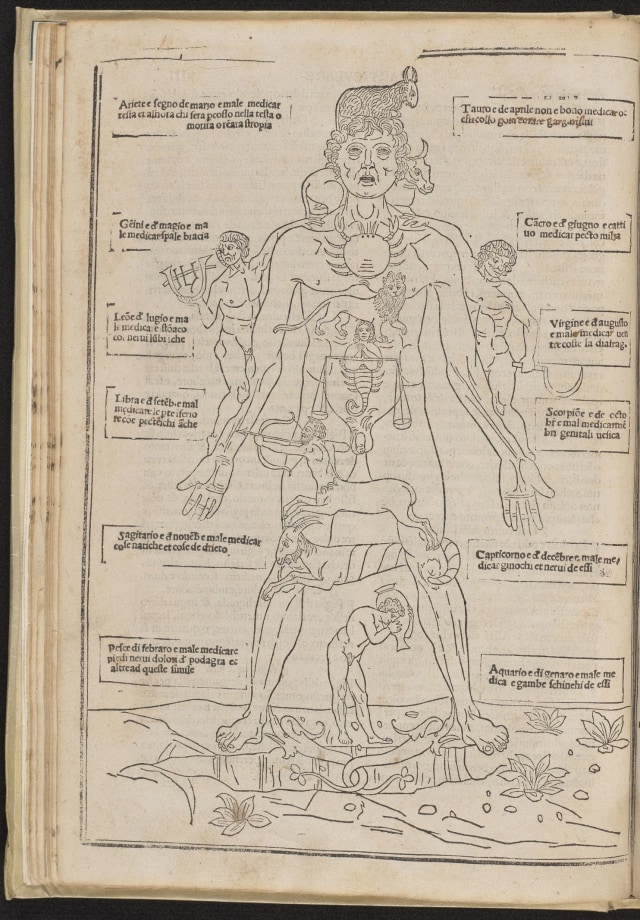 Bagian dari Buku Fasciculus Medicinae  (Foto: New York Academy of Medicine)