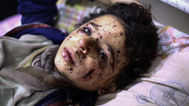 Korban Pengeboman di Wilayah Ghouta (Foto: AFP PHOTO / Amer Almohibany)