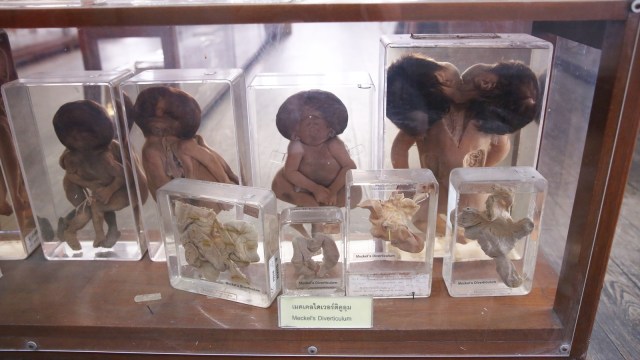 Koleksi di Siriraj Medical Museum (Foto: Flickr / MikeCurran)