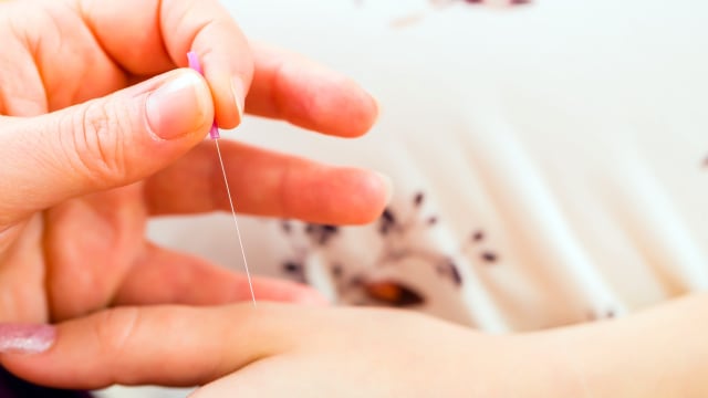 Kenapa Ibu Hamil Perlu Akupunktur? (56089)