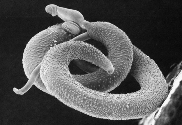 Schistosoma (Foto: Wikimedia Commons)