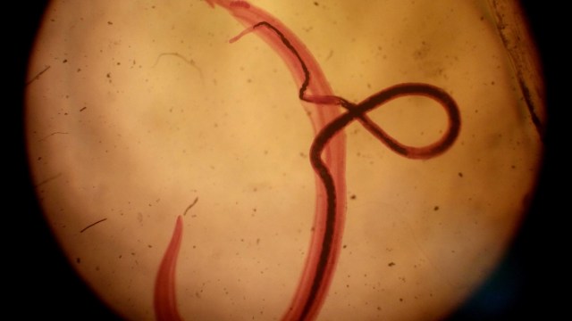 Schistosoma (Foto: Wikimedia Commons)