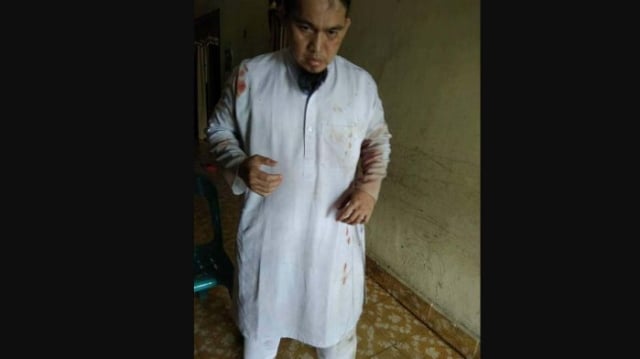 Ustaz yang diserang pria di Aceh (Foto: Istimewa)