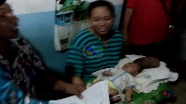 Gambar Daging Tumbuh Di Kepala Gambar Daging Tumbuh Di Kepala