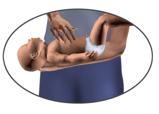 Cara Menolong Bayi yang Tersedak (59288)