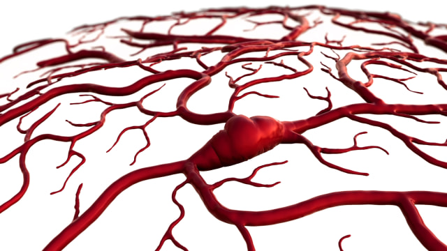Ilustrasi penyumbatan darah di otak. (Foto: Thinkstock)