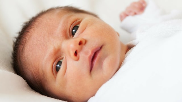 Ciri-ciri Penyakit Kuning pada Bayi Baru Lahir (20724)