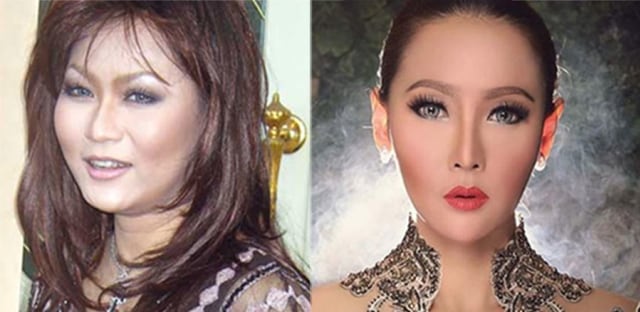 5 Artis Indonesia Dengan Perubahan Wajah Paling Fantastis Oplas Atau Alami Kumparan Com