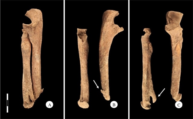 Tulang tangan dengan pisau. (Foto: Micarelli et al./Journal of Anthropological Sciences)