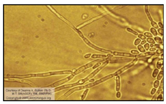 ISOLASI DAN IDENTIFIKASI FUNGI PENYEBAB MIKOSIS