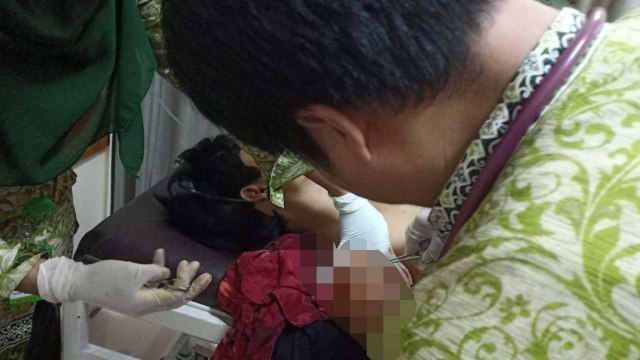 Pelajar di Bogor terluka karena tawuran. (Foto: Dok. Polres Bogor)
