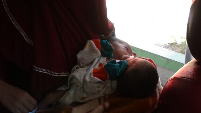 Dinilai Stabil, Bayi Kembar Siam asal Probolinggo Diserahkan Kepada Keluarga