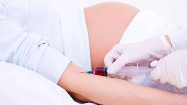 Tes darah ibu hamil. Foto: Thinkstock