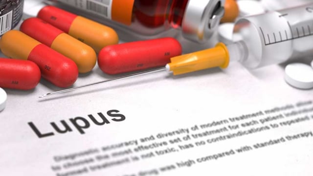 Memahami Ciri-ciri Penyakit Lupus pada Ibu Hamil