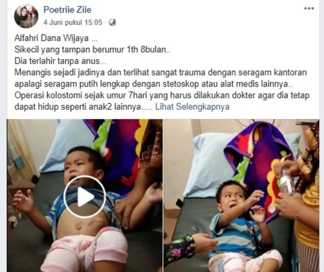 Penderita Astresiani Perlu Penanganan Serius, Netizen Ajak Donasi