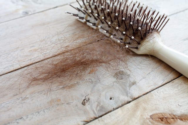 ilustrasi rambut rontok (Foto: thinkstock)