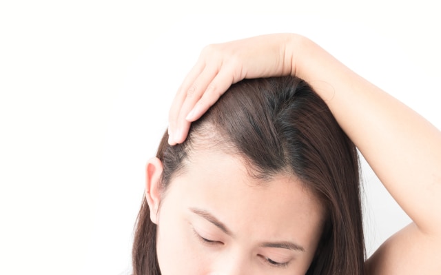 Kata Dokter Ini 8 Tips Perawatan Kulit Kepala Dan Rambut
