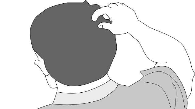 Menggaruk kepala (Foto: OpenClipart-Vectors/PIxabay)