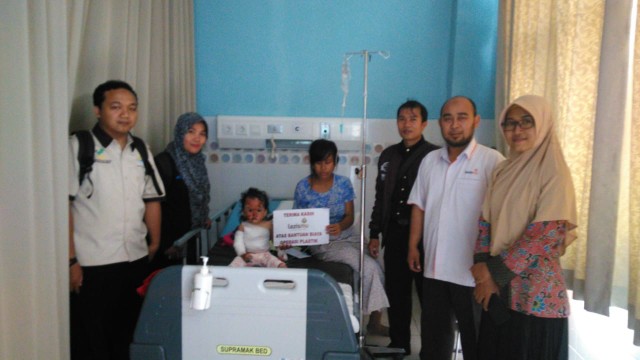 Balita di Tegal Jalani Operasi Plastik Gara-gara Tersiram Air Panas