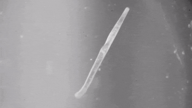 Makhluk tercepat di dunia, Spirostomum ambiguum, menyusutkan tubuhnya. (Foto: Georgia Institute of Technology)