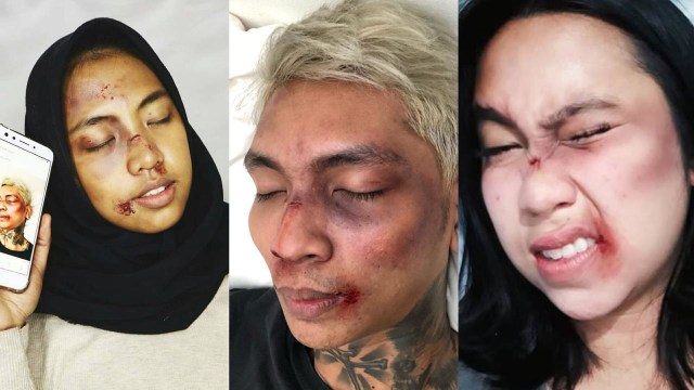 7 Foto Makeup Lebam Young Lex versi Netizen