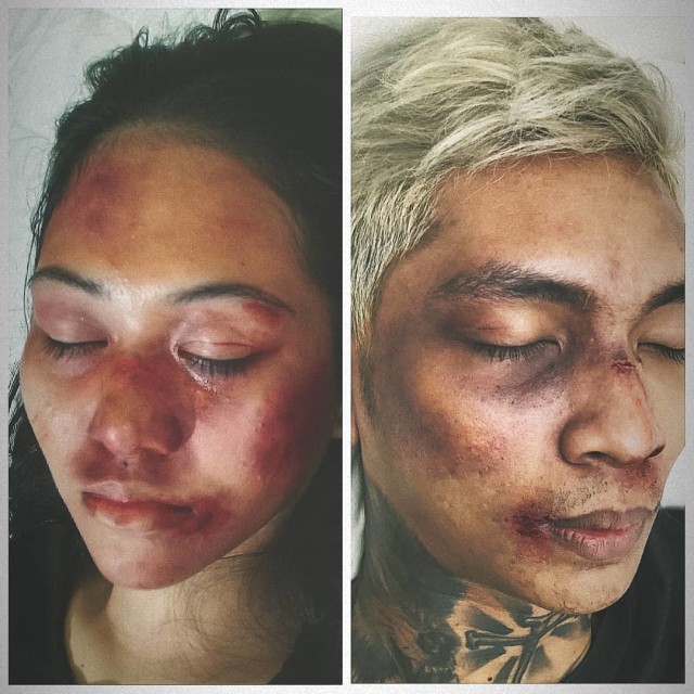 7 Foto Makeup Lebam Young Lex versi Netizen (1)