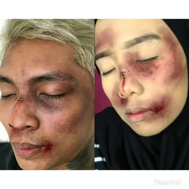 7 Foto Makeup Lebam Young Lex versi Netizen (2)