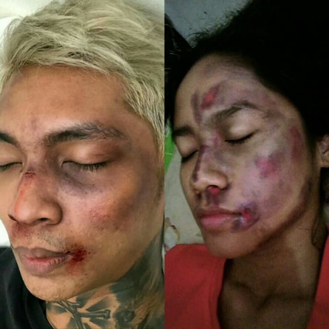 7 Foto Makeup Lebam Young Lex versi Netizen (3)
