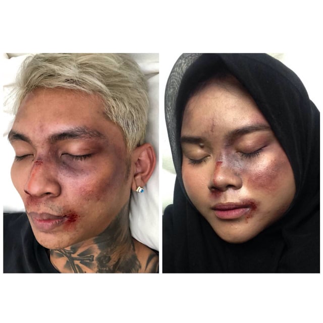7 Foto Makeup Lebam Young Lex versi Netizen (5)