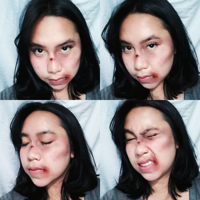7 Foto Makeup Lebam Young Lex versi Netizen (6)