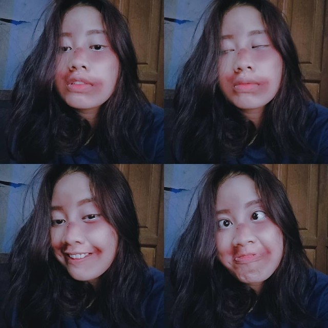 7 Foto Makeup Lebam Young Lex versi Netizen (7)