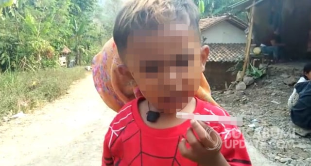 Bocah 2,5 Tahun Asal Sukabumi Pecandu Rokok, Bagaimana Kesehatannya?