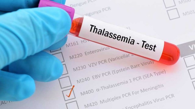 Hamil Dengan Thalasemia Minor