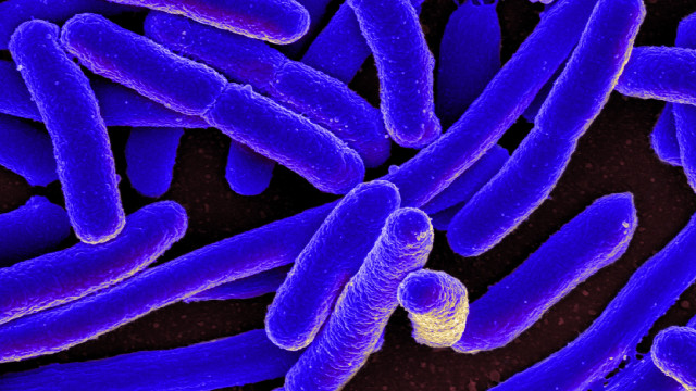 Ilustrasi bakteri e. coli. (Foto: NIAID via wikimedia commons)