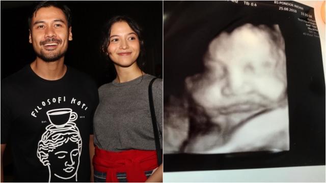 Chicco Jerikho unggah hasil usg anak pertamanya dengan Putri Marino. (Foto: Munady dan Instagram @chicco.jerikho)
