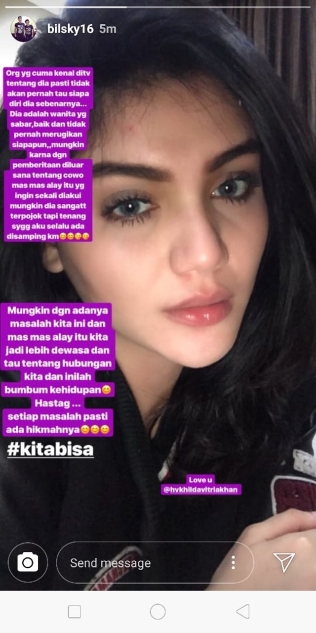 Pujian Billy Syahputra buat Hilda Vitria (Foto: IG @bilsky16)