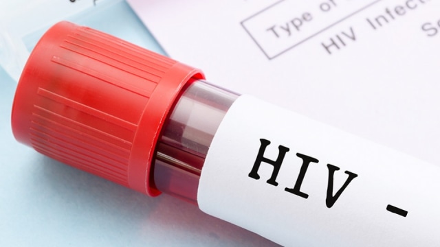 Mengenal Lebih dalam Penyebab HIV dan AIDS | kumparan.com