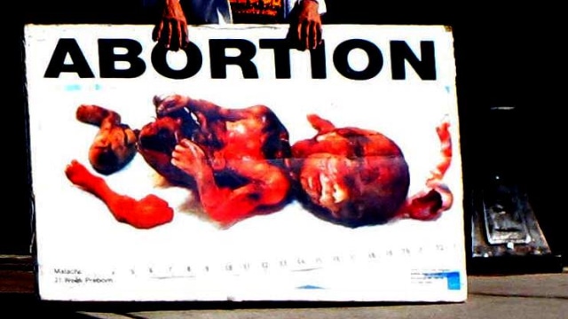 Ilustrasi aborsi (Foto: Raquel Baranow/Flickr)