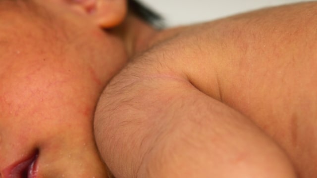 Bayi lahir dengan banyak bulu yang disebut lanugo (Foto: Shutterstock)