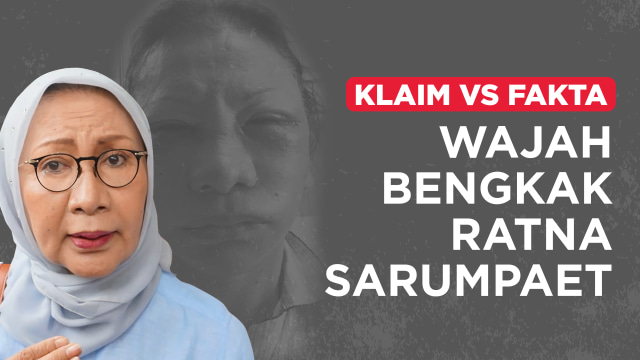 Klaim vs Fakta Wajah Bengkak Ratna Sarumpaet (Foto:  Putri Sarah A/kumparan)