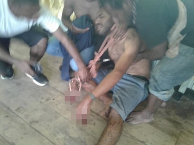 Salah satu korban bentrok warga di Oksibil, Kabupaten Pegunungan Bintang (Foto: Dok. Istimewa)