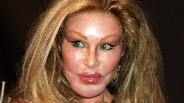 Wajah Jocelyn Wildenstein setelah operasi plastik gagal. (Foto: celebrityabc via Flickr.)