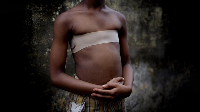 Korset yang Digunakan Setelah 'Menyetrika' Payudara. Foto: Photo by Veronique de Viguerie/Getty Images