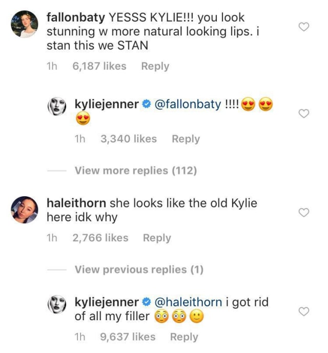 Komentar Kylie Jenner tentang Lip Filler (Foto: Instagram @kyliejenner)