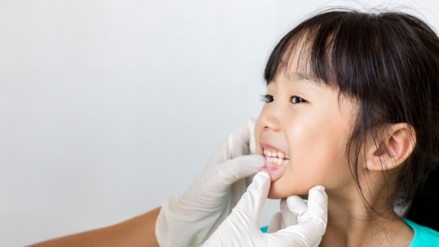 Ilustrasi pemeriksaan gigi anak (Foto: Shutterstock)